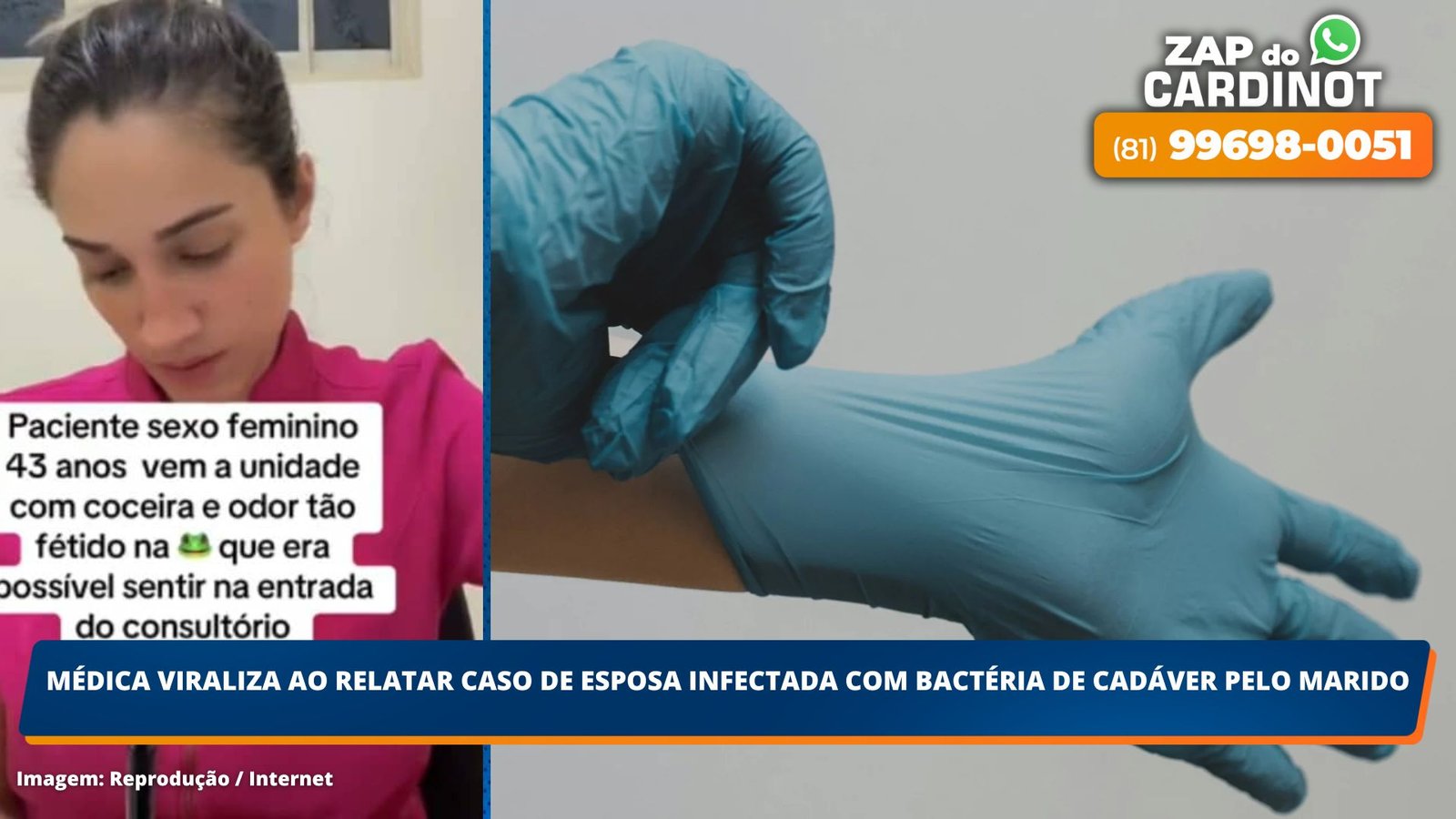 Médica viraliza ao relatar caso de esposa infectada com bactéria de cadáver  pelo marido – CARDINOT