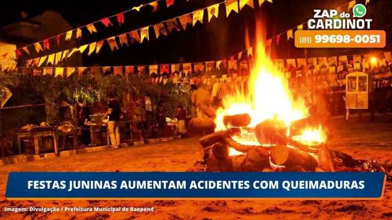 Festas juninas aumentam acidentes com queimaduras
