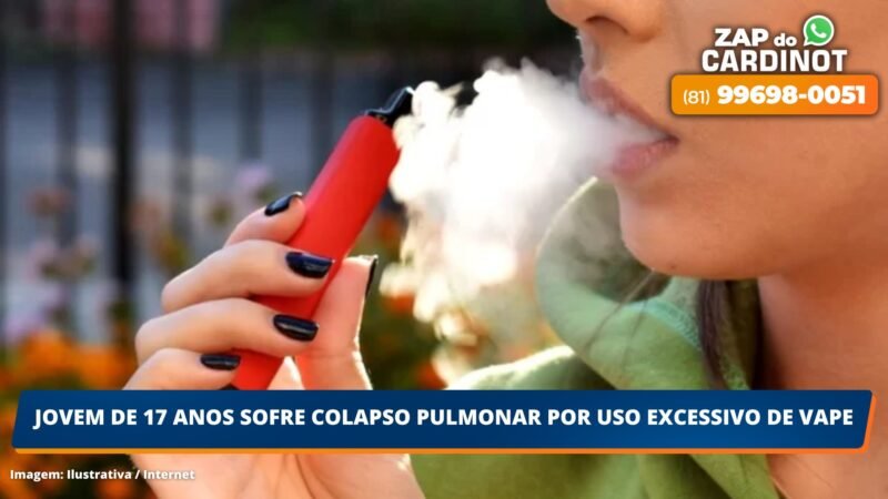 Jovem de 17 anos sofre colapso pulmonar por uso excessivo de vape