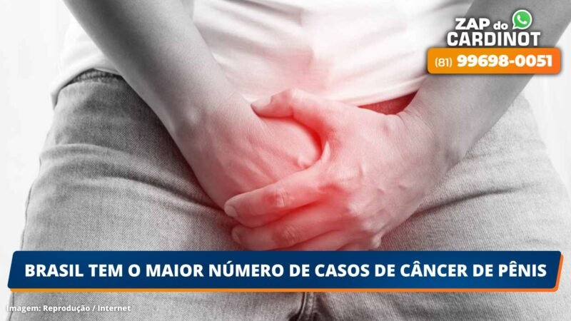 Brasil tem o maior número de casos de câncer de pênis; VEJA OS SINTOMAS