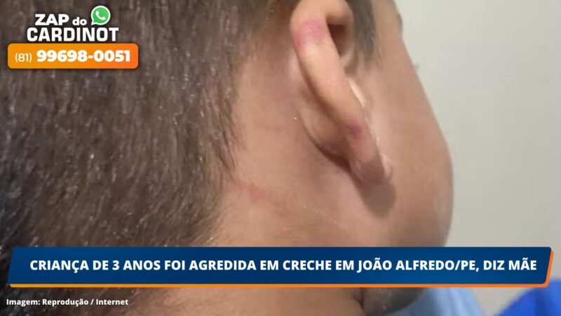 Criança de 3 anos foi agredida em creche em João Alfredo/PE, diz mãe