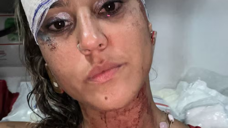 Mulher denuncia agressão de policiais militares em Olinda