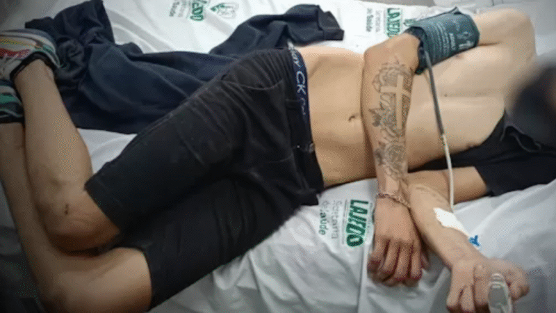 TENENTE LEVA TIRO NA CABEÇA E SOBREVIVE POR MILAGRE APÓS TENTATIVA DE ASSALTO EM SÃO BENTO DO UNA