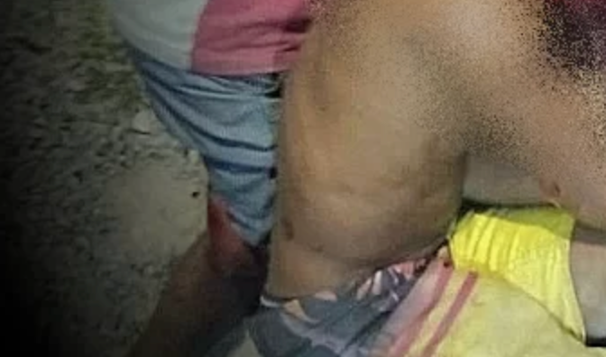 🔫 Duplo homicídio choca o Fragoso: dois homens são executados a tiros em Olinda