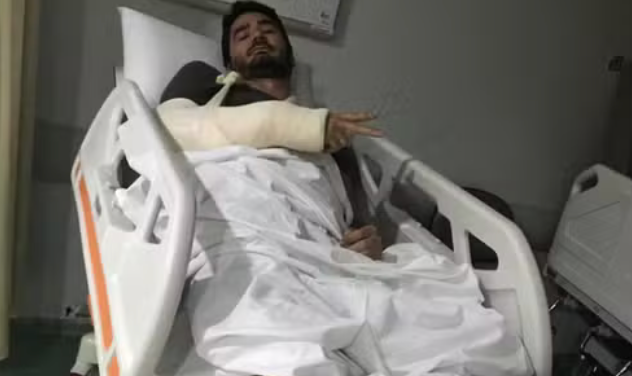 🚨 CICLISTA É ATROPELADO POR PATINETE NA CICLOFAIXA NO RECIFE, FRATURA COTOVELO E PASSA POR CIRURGIA