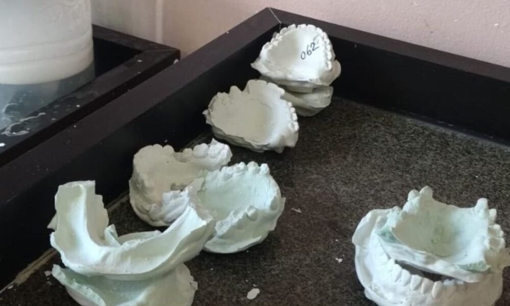 Moldes odontológicos encontrados em situação precária durante fiscalização em Paulista