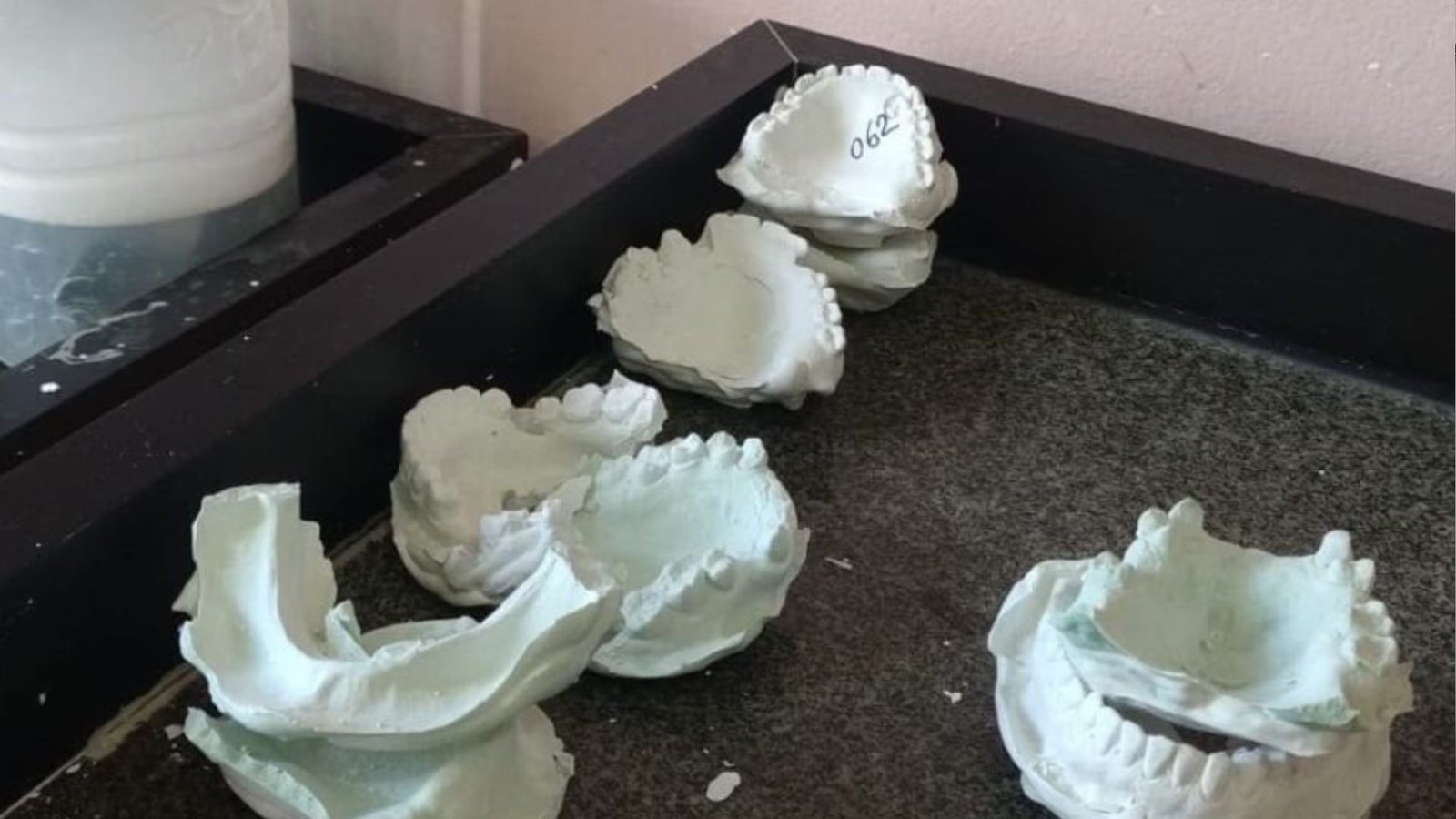 Moldes odontológicos encontrados em situação precária durante fiscalização em Paulista