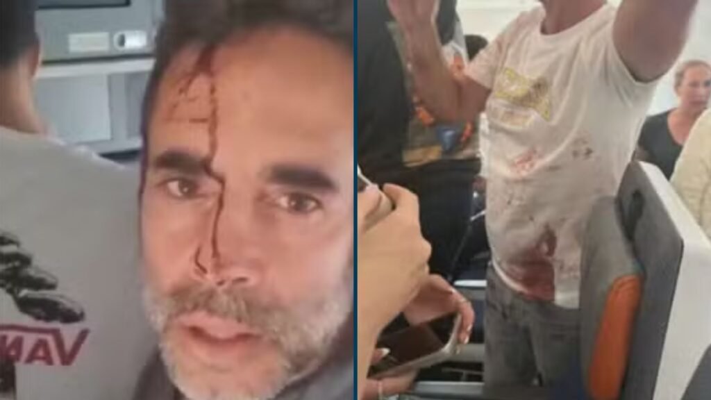 Pessoas com marcas de sangue no voo da Flydubai